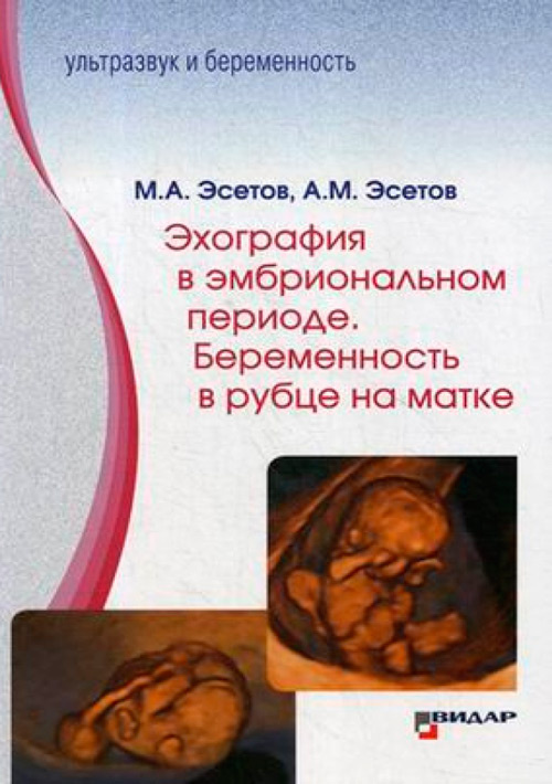NF0017513.files_