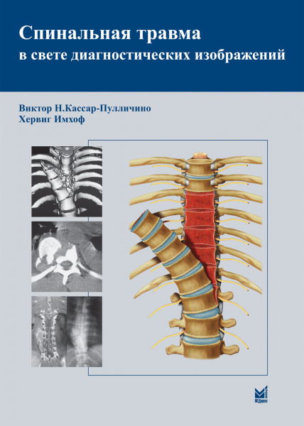 360_Spinalzynaja_travmauKassare