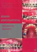 Мини-имплантаты. Ортодонтия будущего