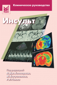 Инсульт