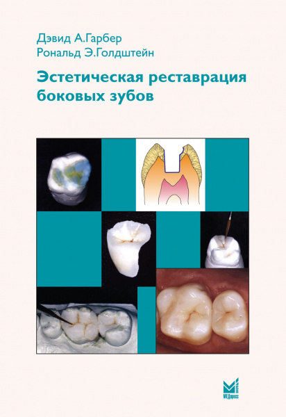350_Jesteticheskaja_restavracija_bokovyh_zubovwGarberz