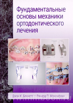 БеннеттПумпа