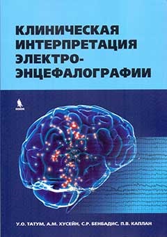 9161
