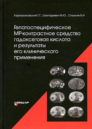 uk529869