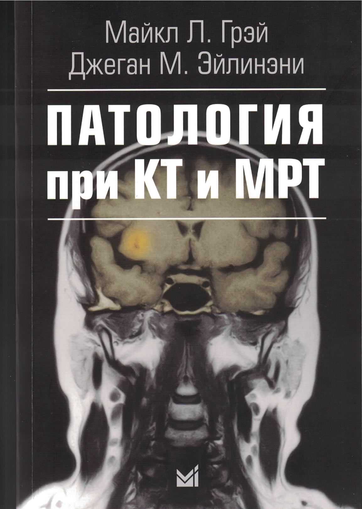 2981