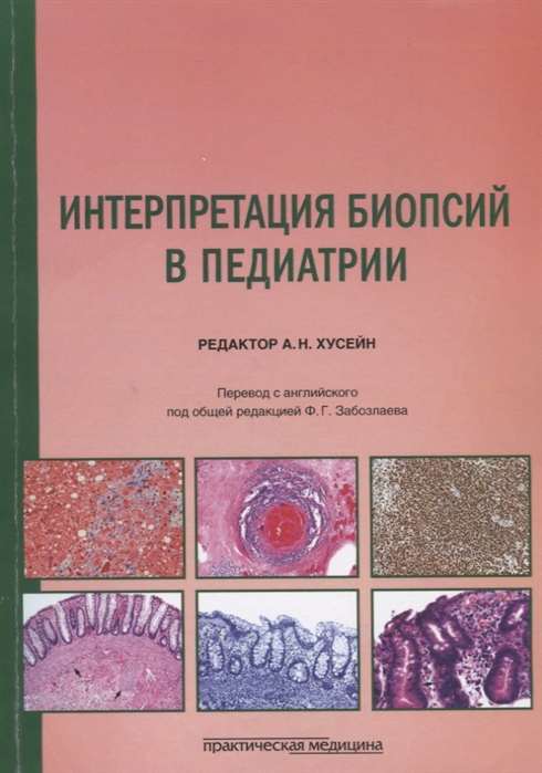 2742884_detail