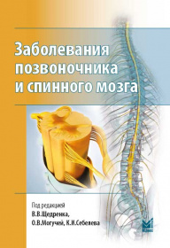 Заболевания позвоночника и спинного мозга.