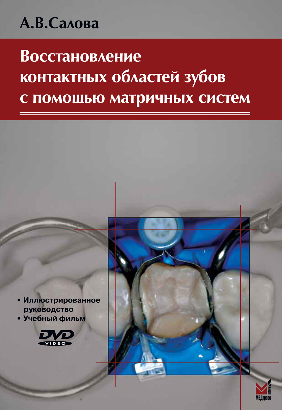 271_Vostanovlenie_kontaktnyh_oblactej_zubovrSalovau.jpg