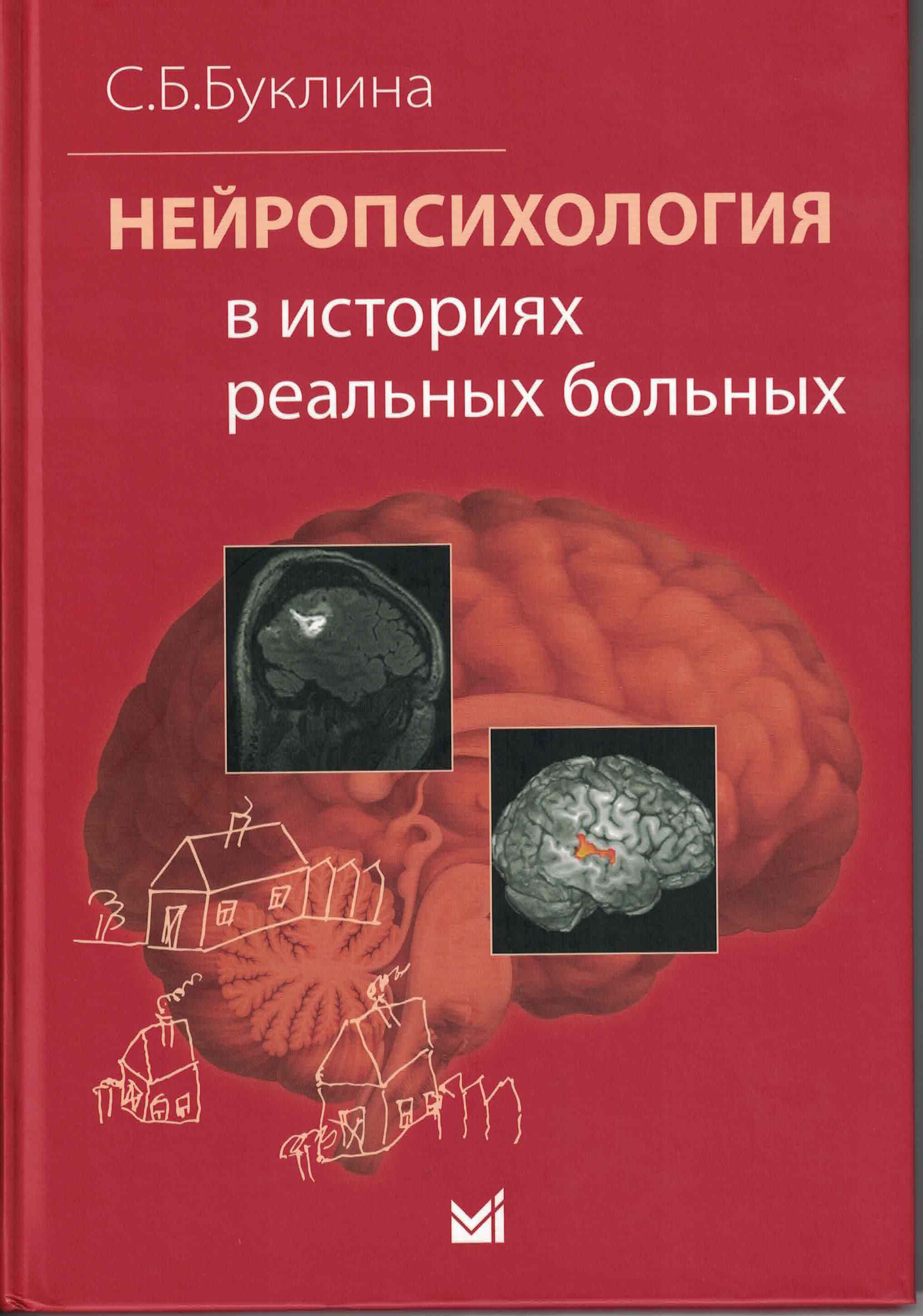 3044
