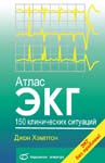 Атлас ЭКГ:150 клинических ситуаций