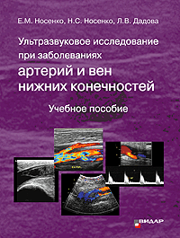 Ультразвуковое исследование при заболеваниях артерий и вен нижних конечностей