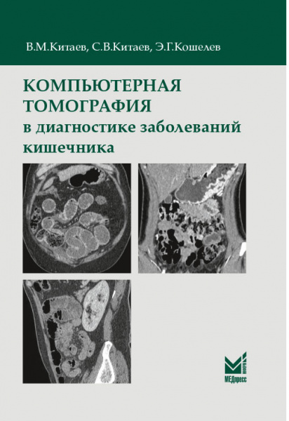 КитаевКишечник