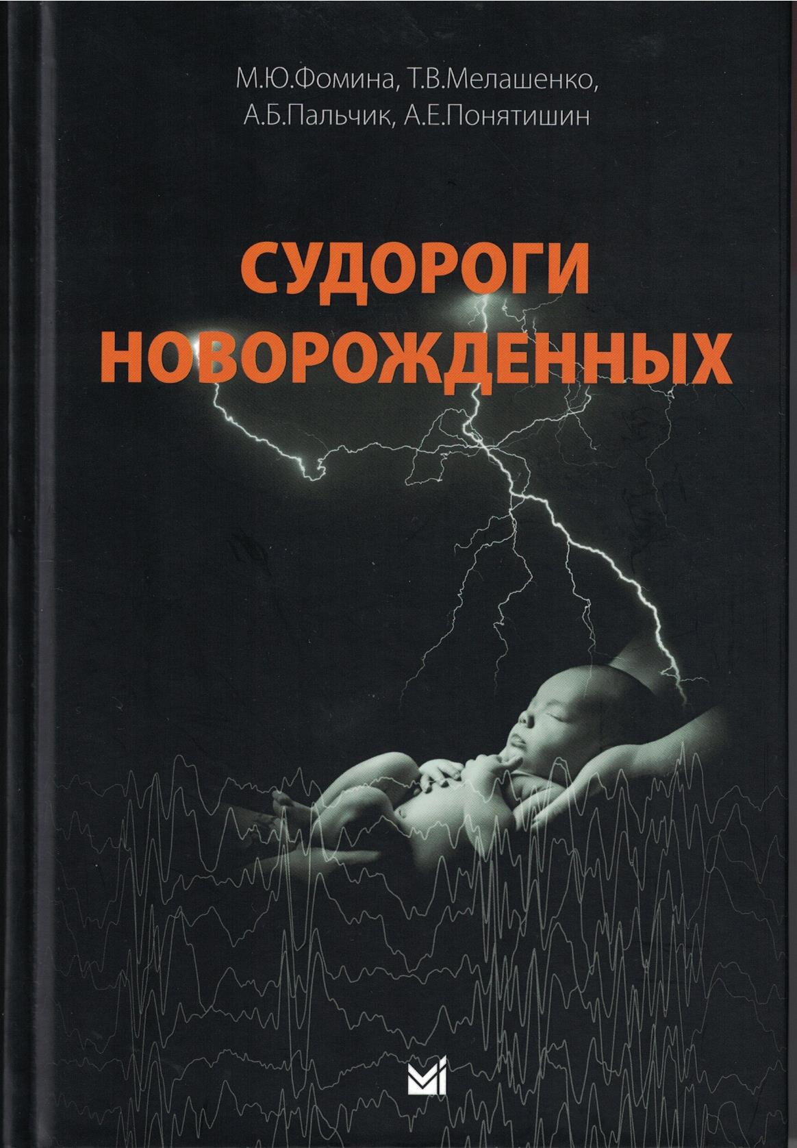 Судороги