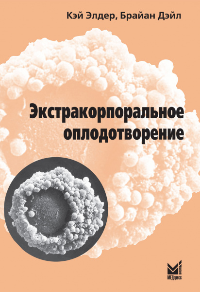 301_Jekstrakorporalcxnoe_oplodotvorenieyJelderx