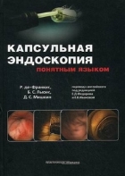 Капсульная эндоскопия понятным языком