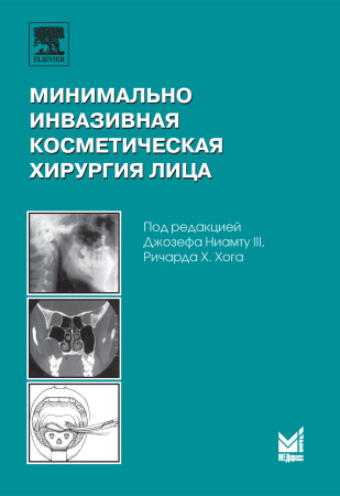 238_Minimalghno_invazivnaja_kosmeticheskajavoNiamtuw.jpg