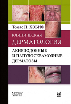Клиническая дерматология. Акнеподобные и папулосквамозные дерматозы.