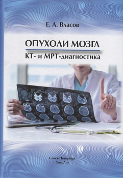 Опухоли мозга,  КТ и МРТ диагностика