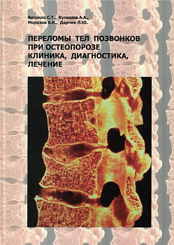 Переломы тел позвонков при остеопорозе. Клиника, диагностика, лечение