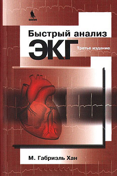 Быстрый анализ ЭКГ