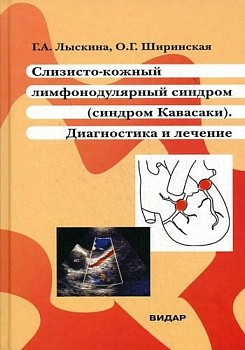 Слизисто-кожный лимфонодулярный синдром (синдром Кавасаки). Диагностика и лечение
