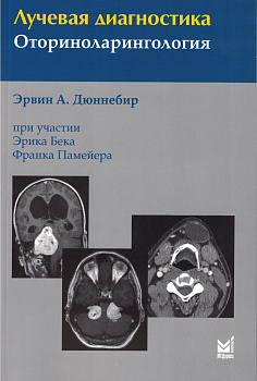 Лучевая диагностика. Оториноларингология.