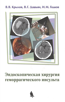 Эндоскопическая хирургия геморрагического инсульта