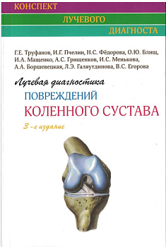 Лучевая диагностика повреждений коленного сустава