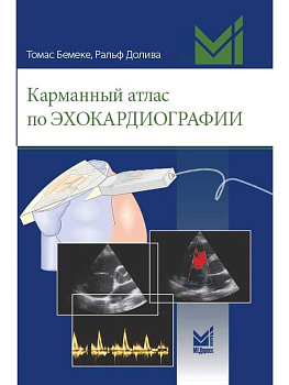 Карманный атлас по эхокардиографии
