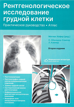 Рентгенологическое исследование грудной клетки, 2-е