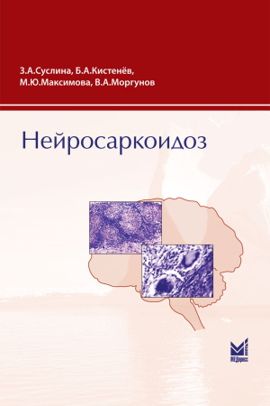 368_NejrosarkoidozxSuslinab.jpg