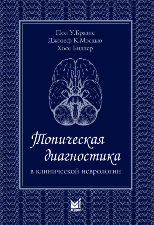 Бразис