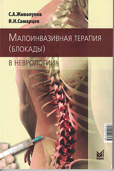 Малоинвазивная терапия (блокады) в неврологии