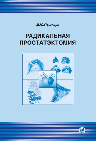 094_Radikalqonaja_prostatjektomijahPushkarbwc.jpg