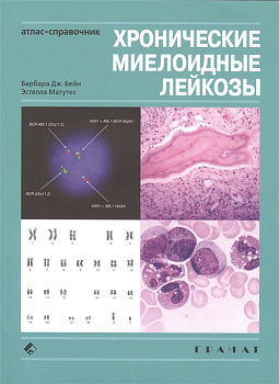 Хронические миелоидные лейкозы. Атлас-справочник