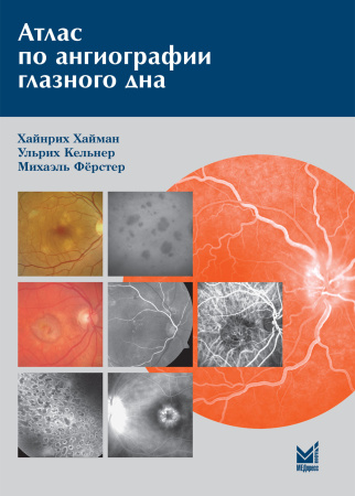 281_Atlas_po_angiografii_glaznogo_dnakHajmanv.jpg
