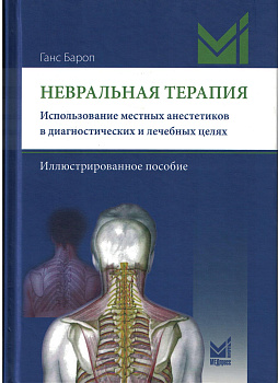 Невральная терапия.