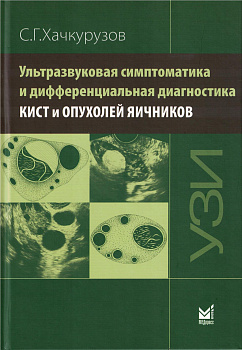 Ультразвуковая симптоматика и дифференциальная диагностика кист и опухолей яичников