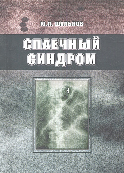 Спаечный синдром