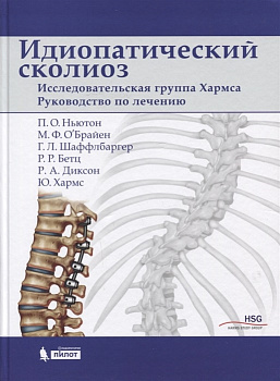 Идиопатический сколиоз. Исследовательская группа Хармса