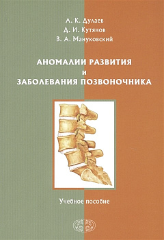 Аномалии развития и заболевания позвоночника