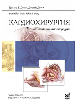 Кардиохирургия. Техника выполнения операций.