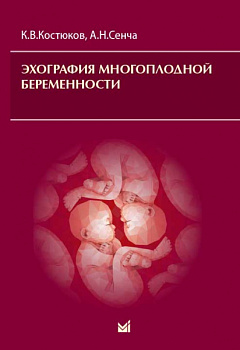 Эхография многоплодной беременности