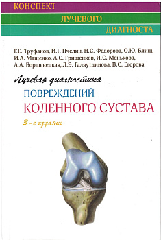 Лучевая диагностика повреждений коленного сустава