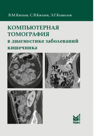КитаевКишечник