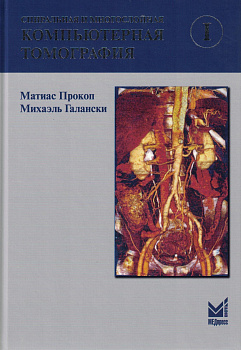 Спиральная и многослойная компьютерная томография. 1 том