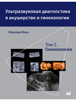 Ультразвуковая диагностика в акушерстве и гинекологии. Т.2. Гинекология