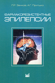 Фармакорезистентные эпилепсии