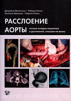 Расслоение аорты: личные истории пациентов и достижения, спасшие им жизнь