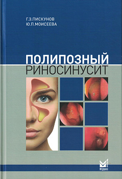 Полипозный риносинусит
